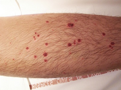 Fig. 15.5