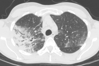 Fig. 15.2