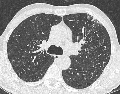 Fig. 15.9