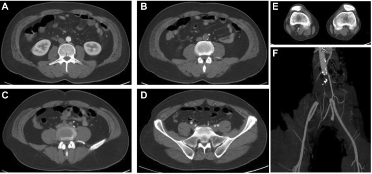 Fig 1