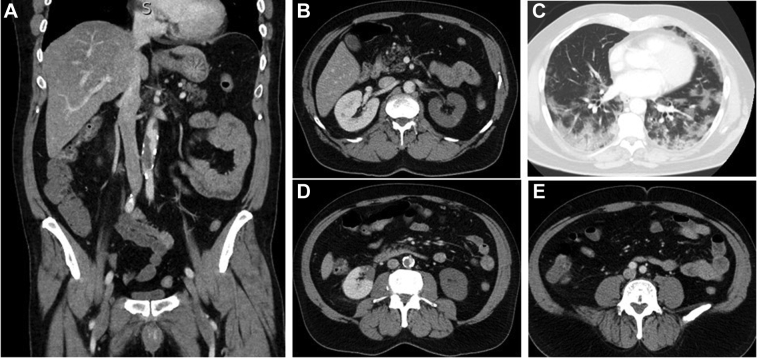 Fig 3