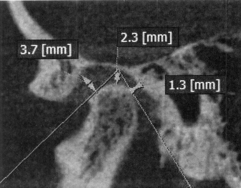 Fig. 2