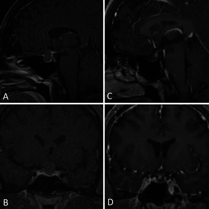 FIG. 1.