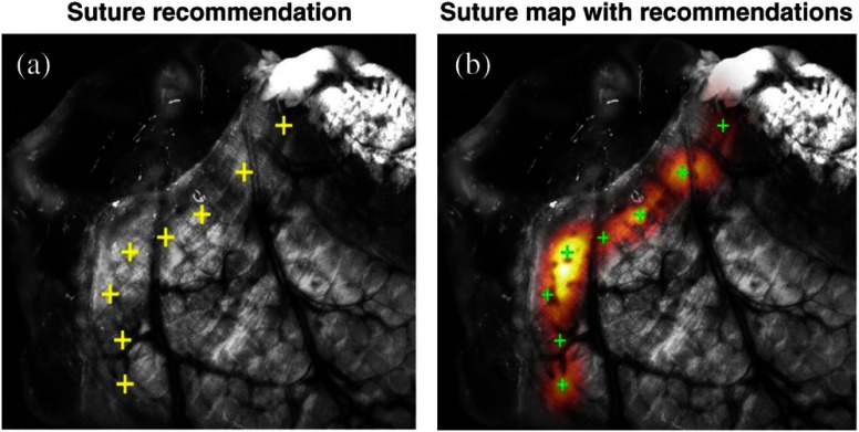 Fig. 11