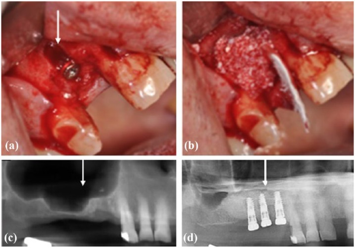 Figure 3.