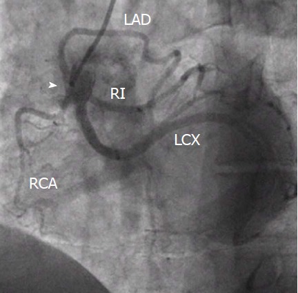 Figure 13