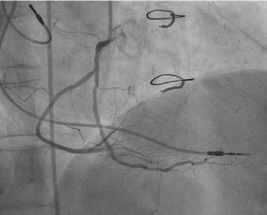 Figure 14