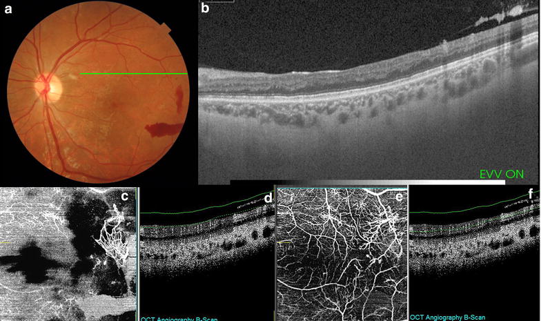 Fig. 7