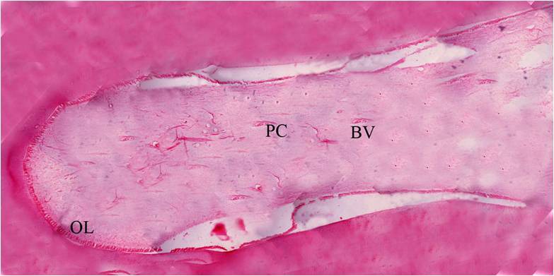 Figure 13: Histology of the decalcified tooth section
showing the entire pulp tissue (HandE, 4X).