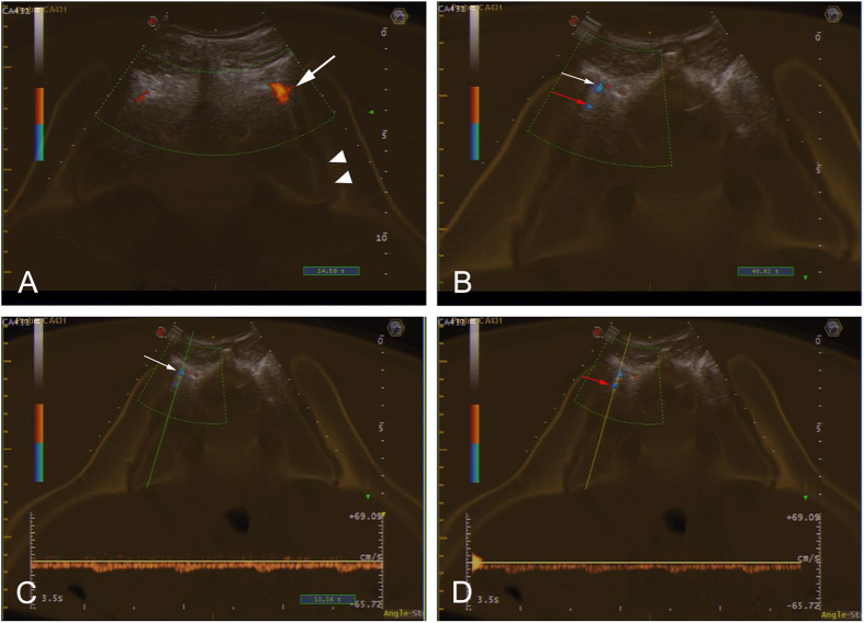 Figure 4