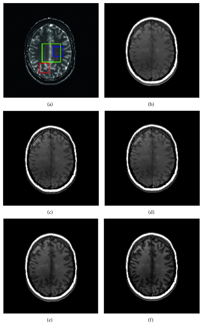 Figure 2