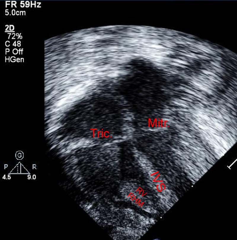 Figure 2