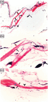 Figure 13.