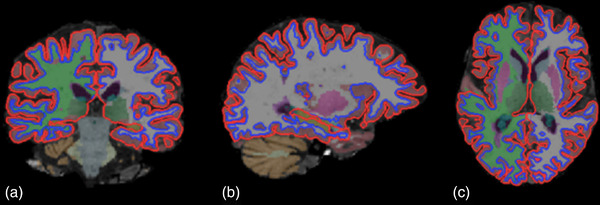 FIGURE 3