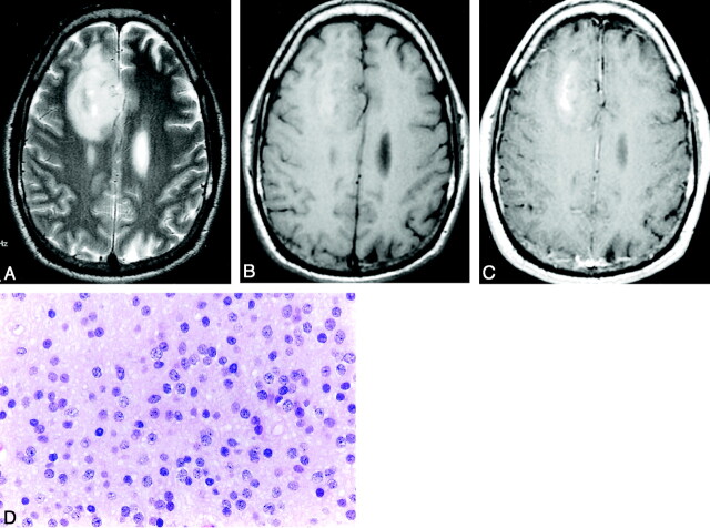 Fig 3.