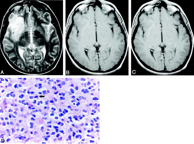 Fig 2.