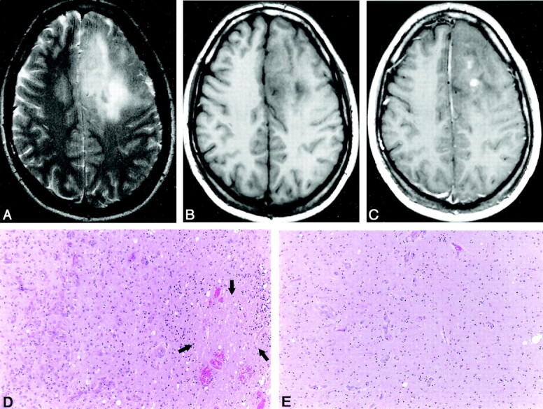 Fig 1.