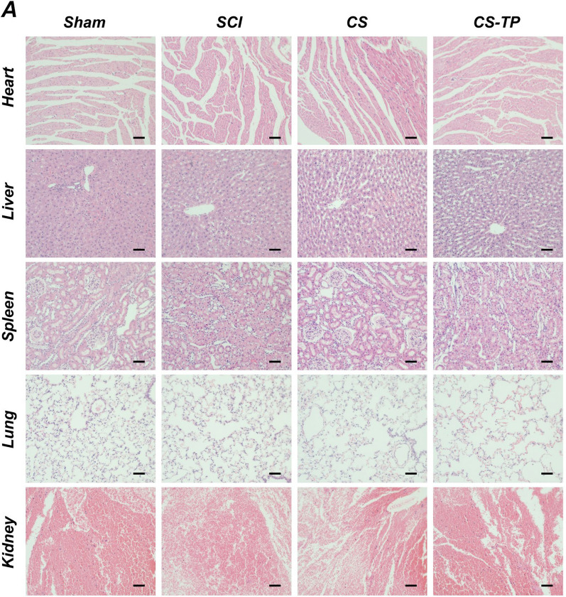 Fig. 12