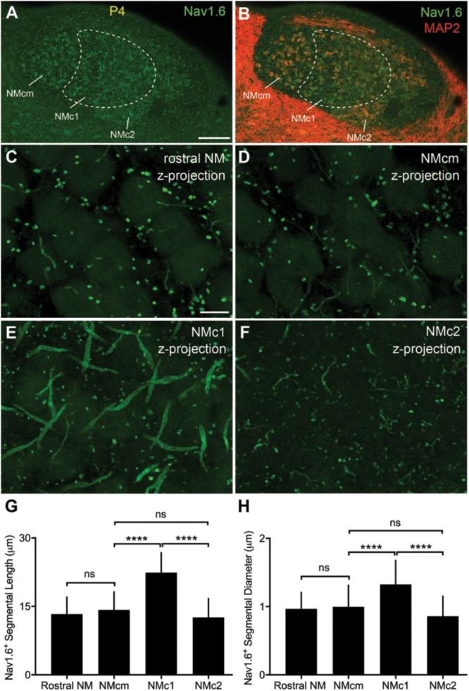 FIGURE 12