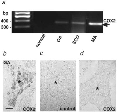 Fig 4.