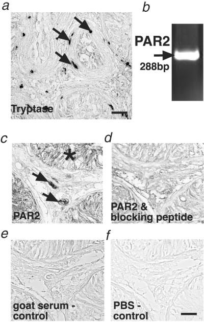 Fig 3.