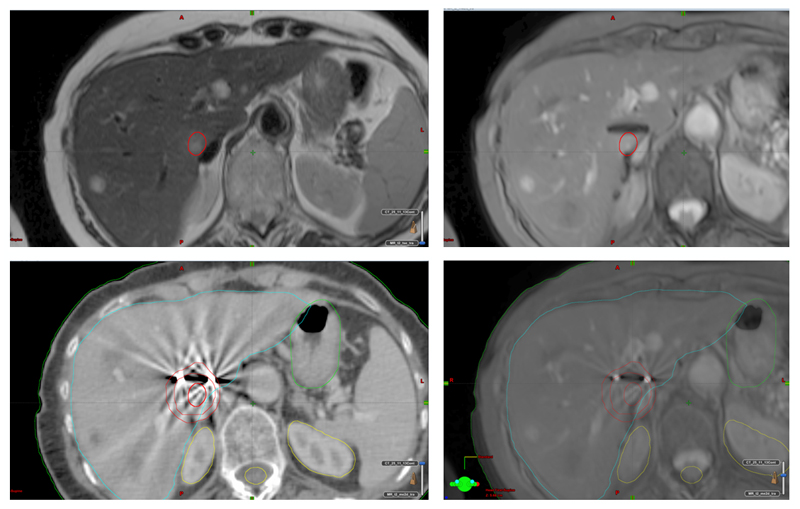 Figure 13