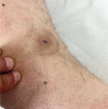 Fig. 4