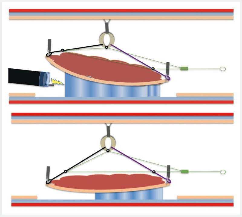 Fig. 2