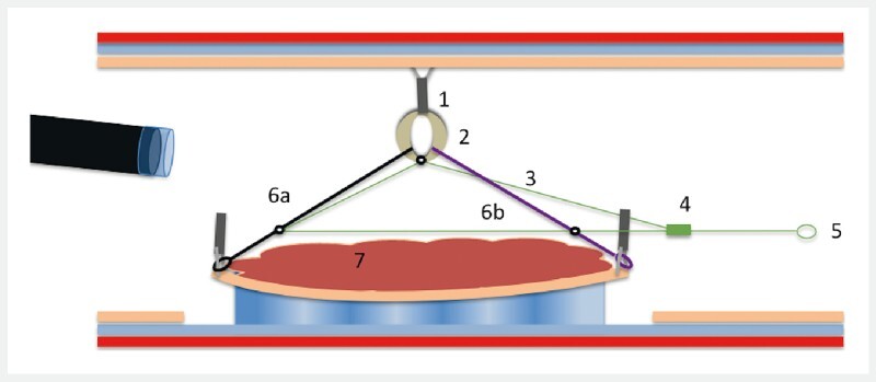 Fig. 1