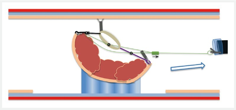 Fig. 3