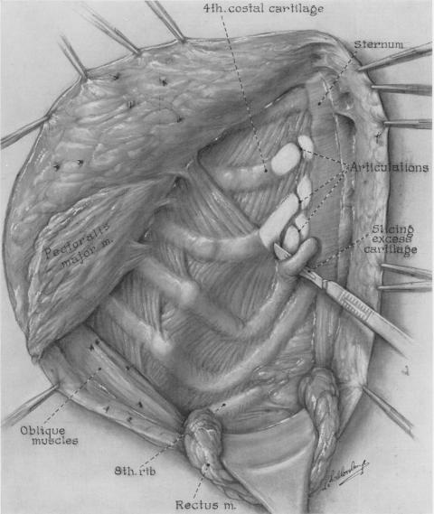 Fig. 3B.