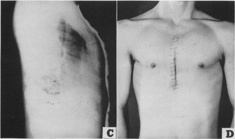 Fig. 1. C and D.