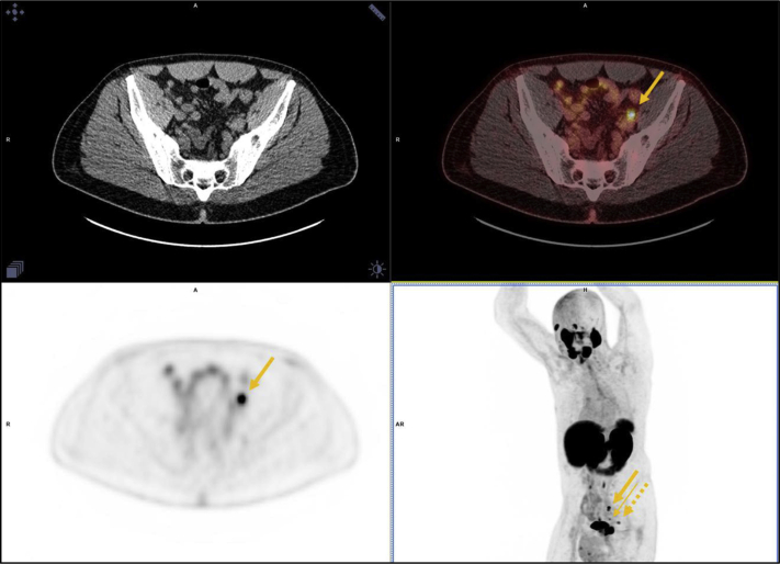 Figure 2