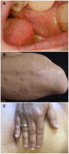 Figure 1