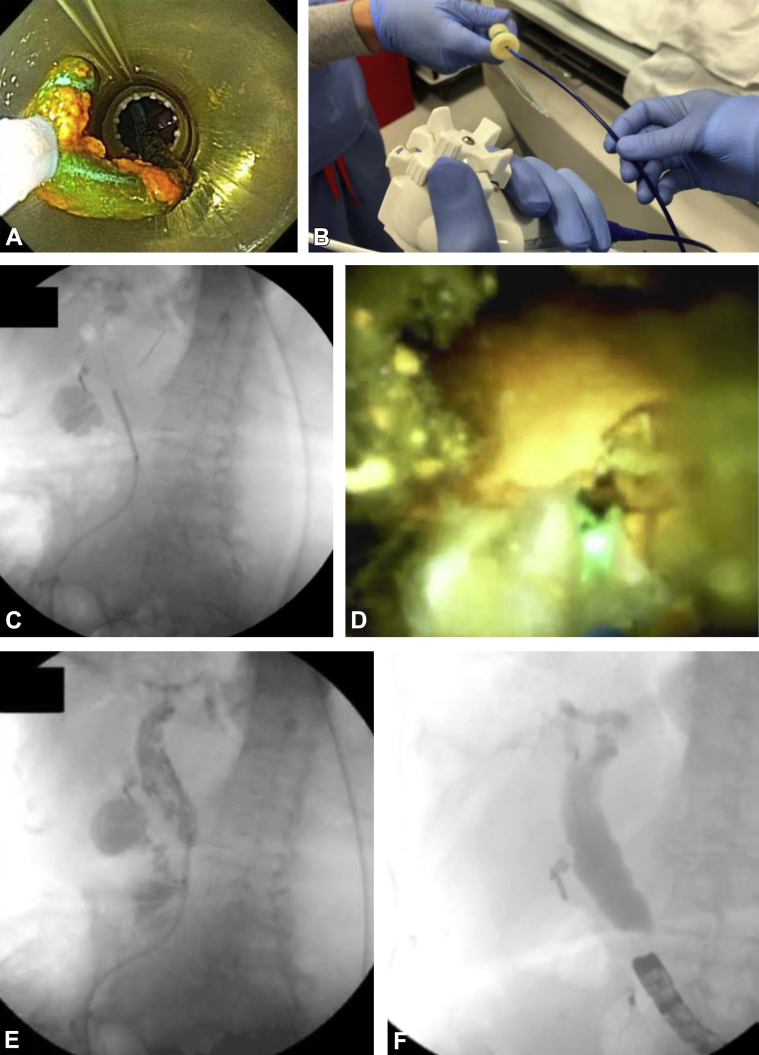 Figure 2