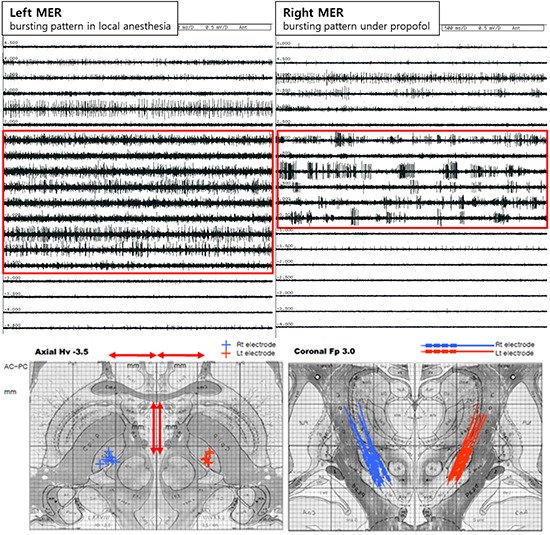 graphic file with name jkms-29-1278-ab001.jpg