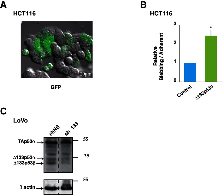 Figure 5—figure supplement 1.