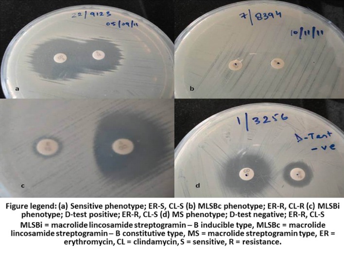 [Table/Fig-2]: