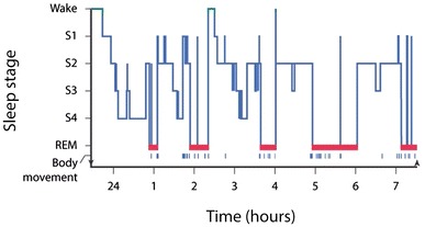 Fig. 1