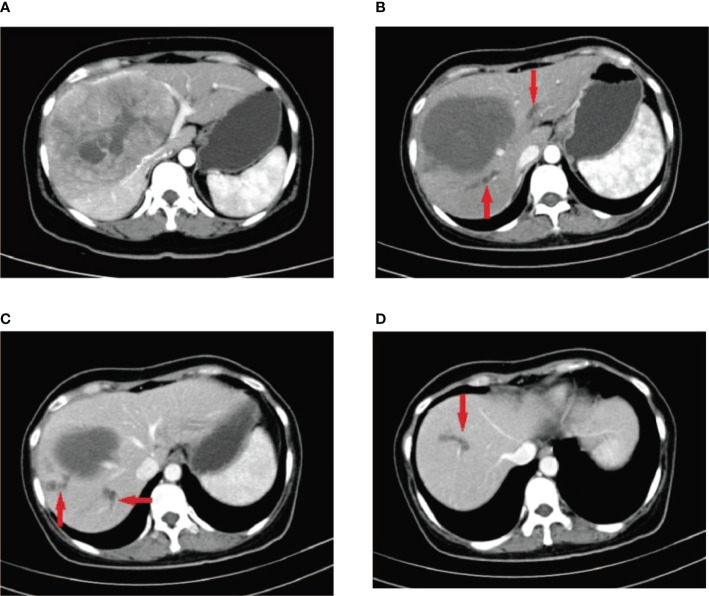 Figure 1