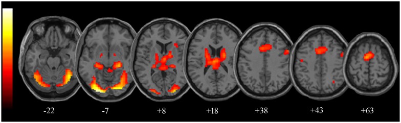 Fig 3