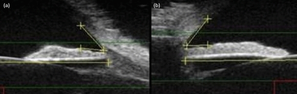 Fig. 5