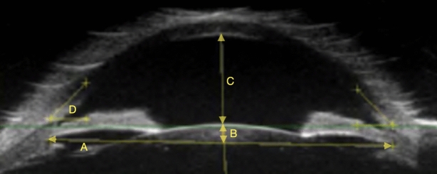 Fig. 3