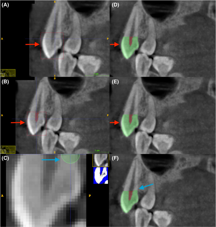 FIGURE 3