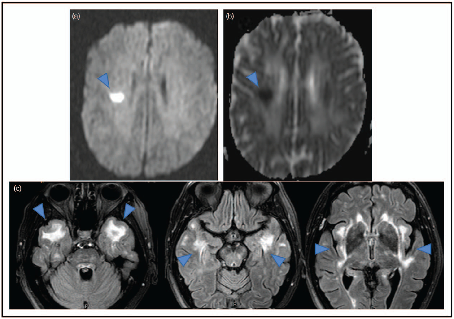 FIGURE 1.