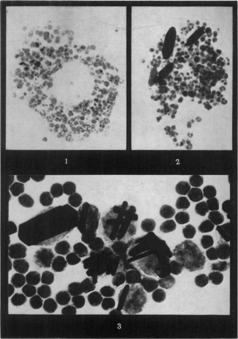 Figs. 1-3