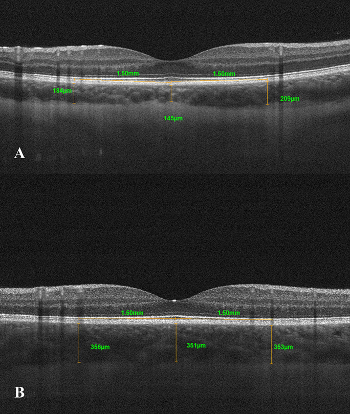 Fig. 2