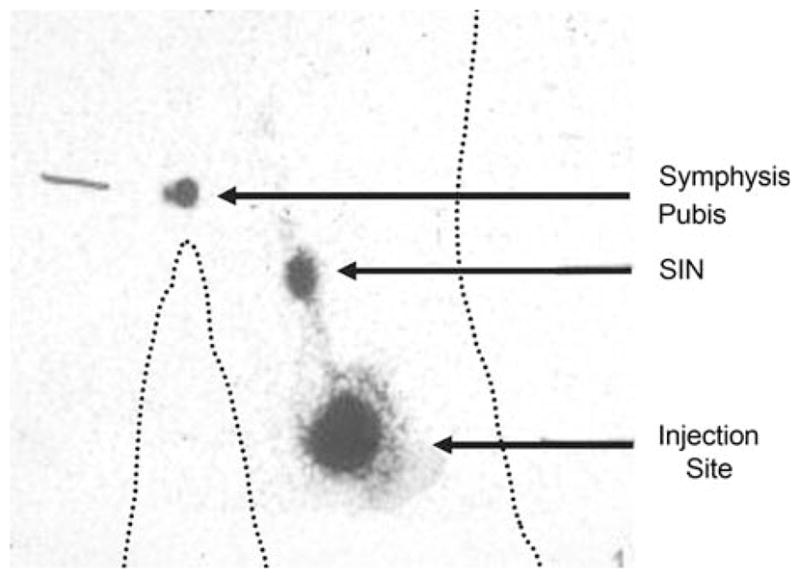 FIG. 1