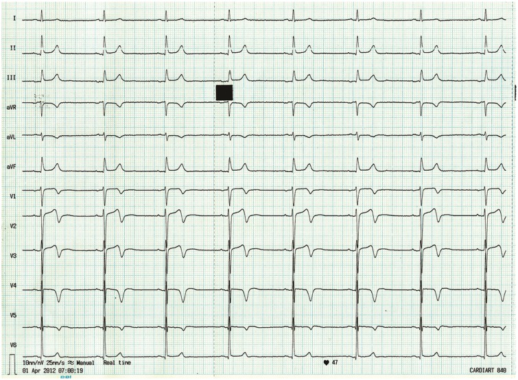 Figure 1