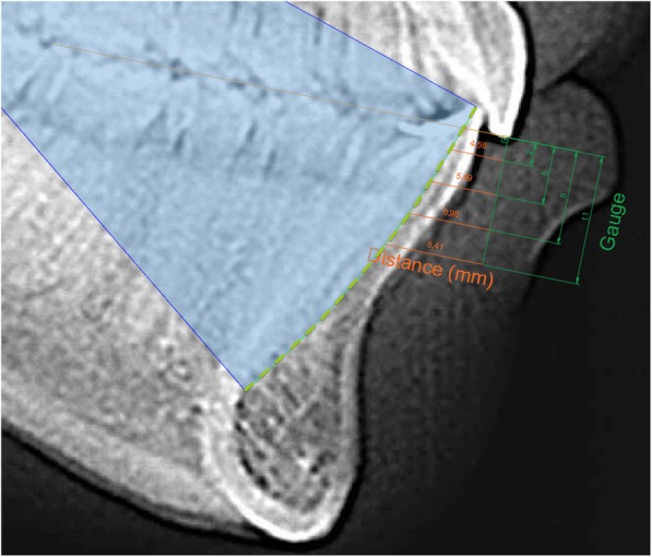 Fig. 4